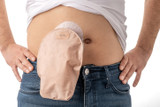 How to Manage Ostomy Ballooning