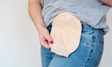 Everything You Need To Know About Ostomy Surgery Recovery