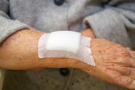 Types of Wound Dressings & Choosing The Right One