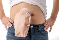 How to Manage Ostomy Ballooning