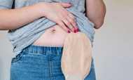 Benefits of Using a Closed-End Ostomy Pouch