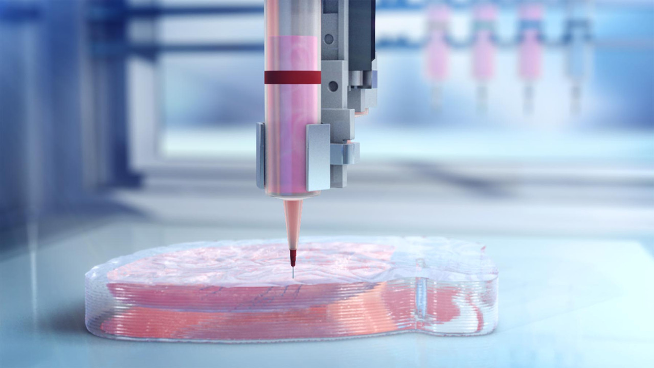 Is Bioprinting the Future of Organ Transplants?