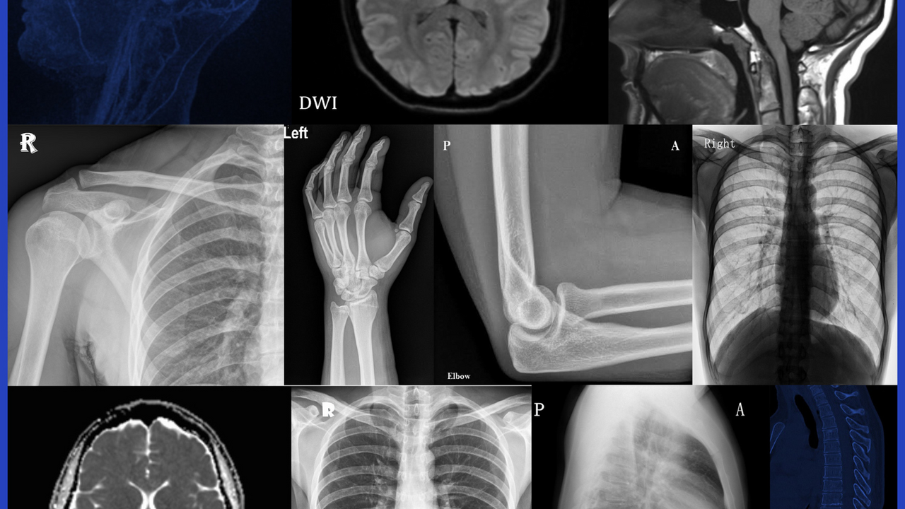 The Advantages of Using Radiology in Modern Healthcare