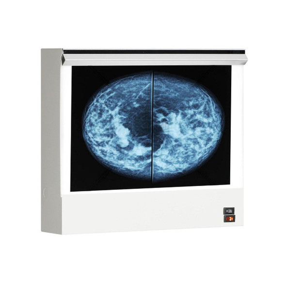 VuPlus Mammography Viewer