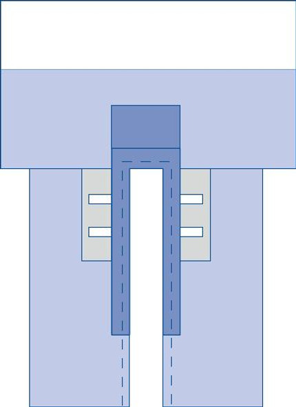 Sterile CV Split Surgical Drape with Clear Anesthesia Pouch