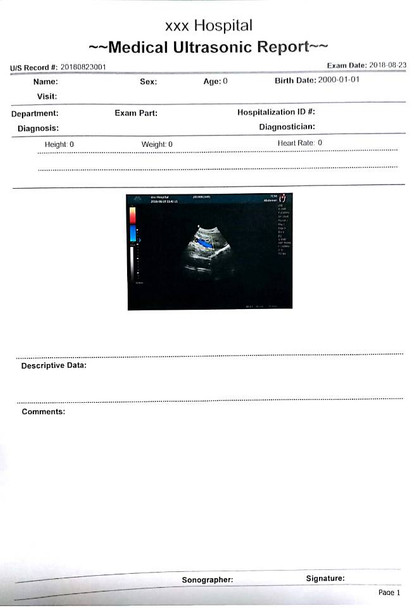 MSLCU46002 Trolley Color Doppler Ultrasound System — 19-Inch HD Monitor, 10.4-Inch Touchscreen, 3D/4D Imaging, Four Probe Ports | Two-Probe Configuration