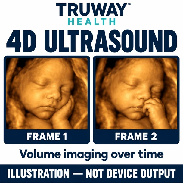 Truway Health™ SUN-906A 3D/4D Color Doppler Ultrasound System – Multi-Array Diagnostic Ultrasound Machine with Convex, Linear & Transvaginal Probes