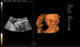 MSLCU46002 Trolley Color Doppler Ultrasound System — 19-Inch HD Monitor, 10.4-Inch Touchscreen, 3D/4D Imaging, Four Probe Ports | Two-Probe Configuration