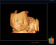 MSLCU46002 Trolley Color Doppler Ultrasound System — 19-Inch HD Monitor, 10.4-Inch Touchscreen, 3D/4D Imaging, Four Probe Ports | Two-Probe Configuration