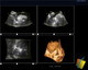 MSLCU46002 Trolley Color Doppler Ultrasound System — 19-Inch HD Monitor, 10.4-Inch Touchscreen, 3D/4D Imaging, Four Probe Ports | Two-Probe Configuration