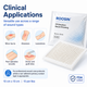 ROOSIN Oil Emulsion Gauze Dressing — 10 cm × 10 cm | 10/Box | Factory-Direct