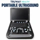 Truway Health™ SUN-906A 3D/4D Color Doppler Ultrasound System – Multi-Array Diagnostic Ultrasound Machine with Convex, Linear & Transvaginal Probes