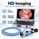 Medical Full HD Endoscope Camera System with 30W LED Cold Light Source & 11.6" Monitor – 3-in-1 Portable Imaging Unit