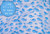 Whale Hello There - Swaddle Set