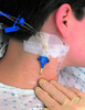 3m&trade; Tegaderm&trade; Transparent Film Dressing MMM1627EA