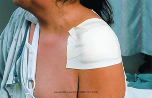 3M&trade; Transpore Surgical Tape MMM15281CS