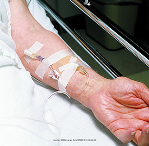 3m&trade; Durapore&trade; Surgical Tape MMM15382EA