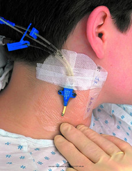 3m&trade; Tegaderm&trade; Transparent Film Dressing MMM1626EA