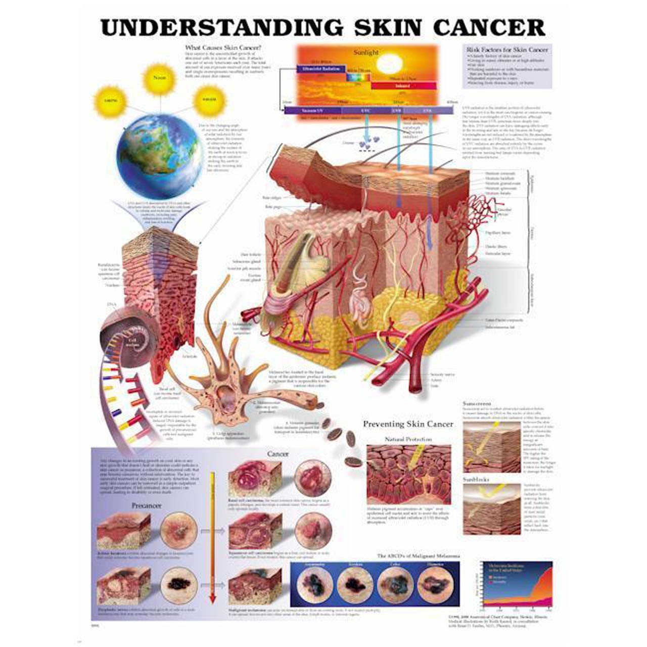 Skin Cancer Chart