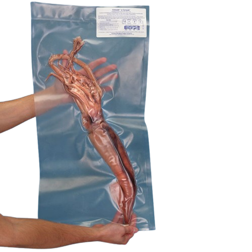 Squid (Loligo Pealei or Ommastrephes Illecebrosa), Double Injected ...