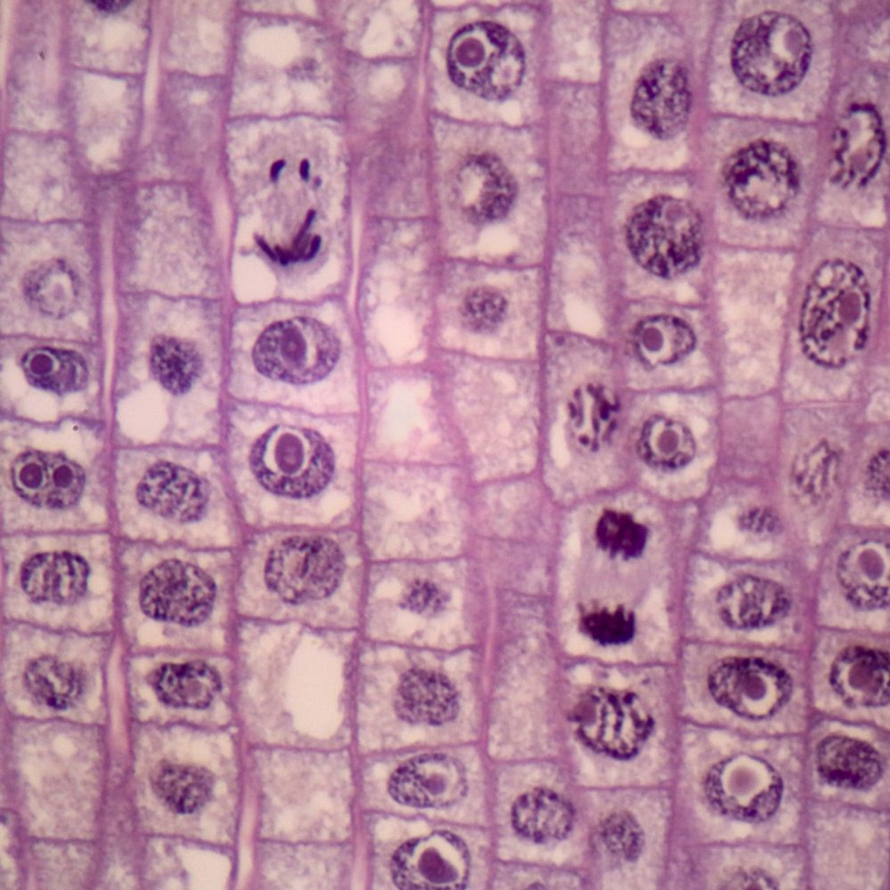 Onion Mitosis, l.s. Thin Microscope Slide - Southern ...