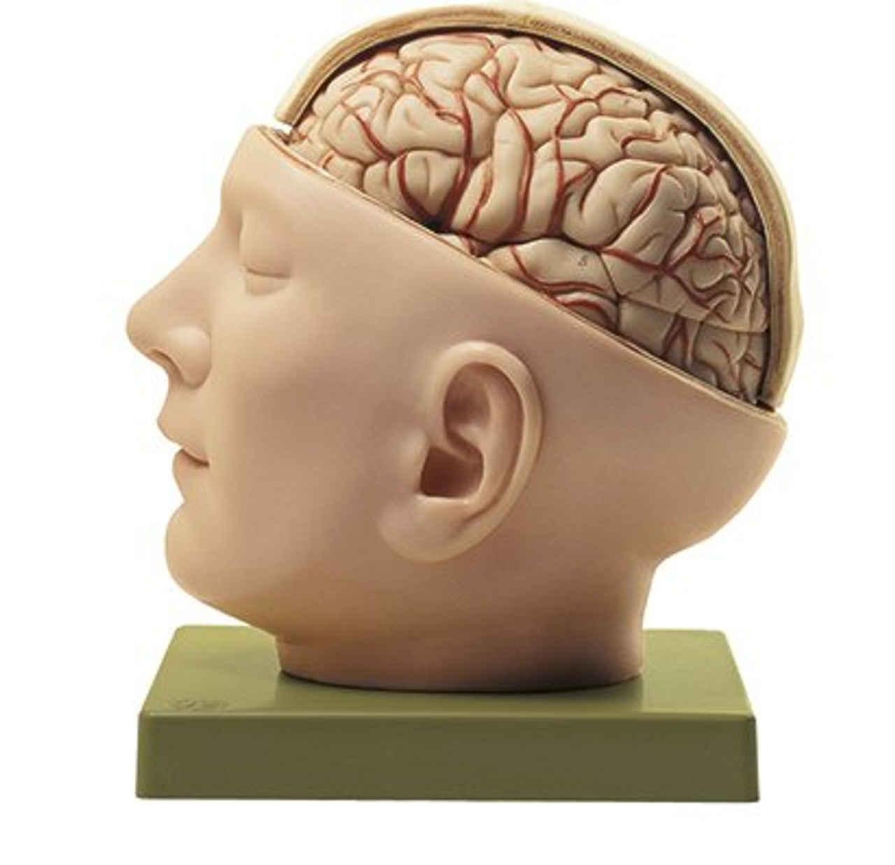 Somso Base Of The Head Anatomical Model 6360