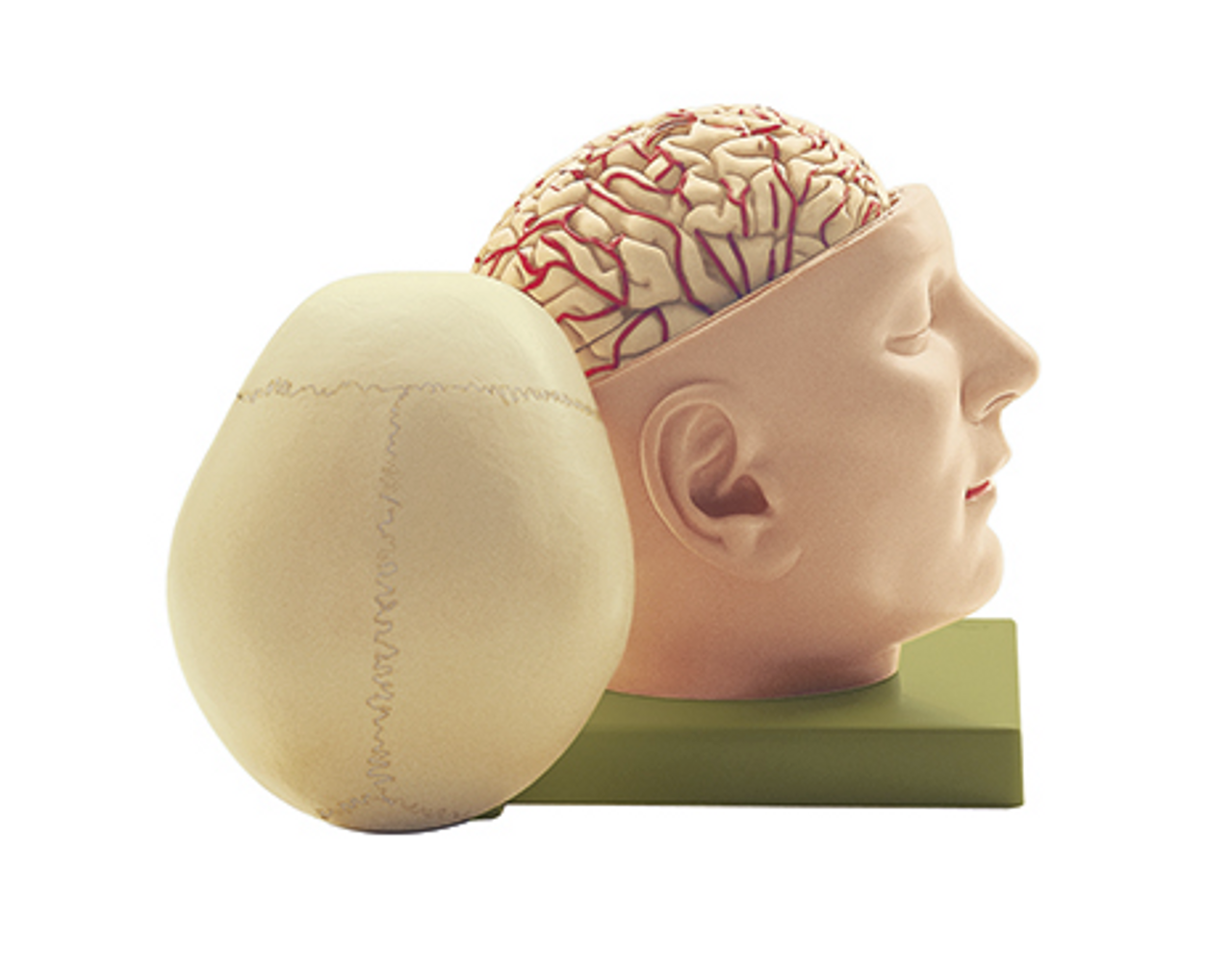 Somso Base Of The Head Anatomical Model 3220