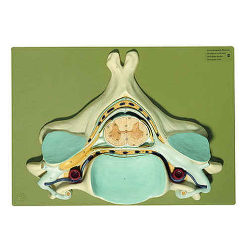 Somso Fifth Cervical Vertebra, Anatomical Model