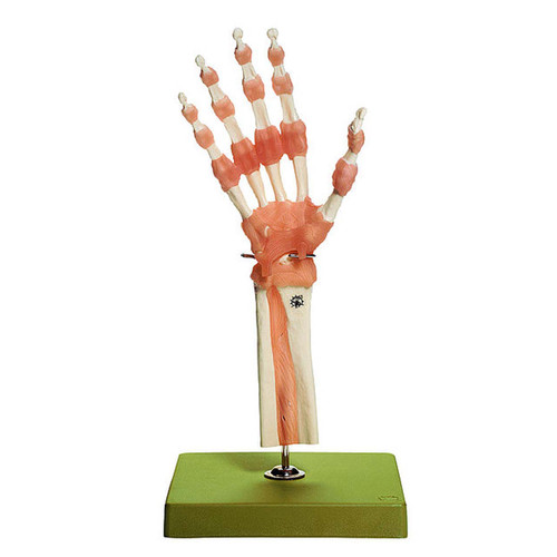 Somso Functional Model of the Hand and Finger Joints