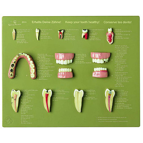 Somso Case of Teeth "Keep Your Teeth Healthy", Anatomical Model