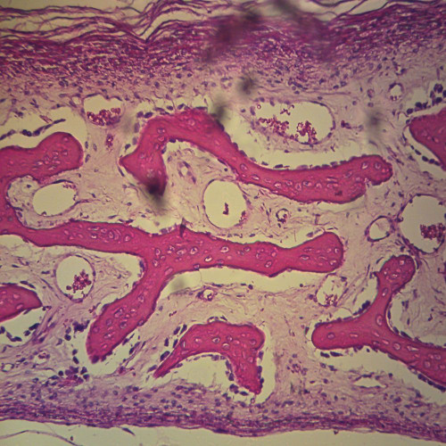 Bone, Developing Membrane