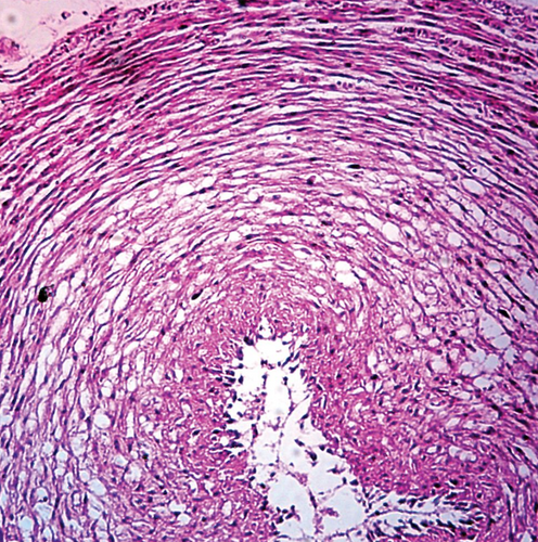 Mucous Tissue, cross section