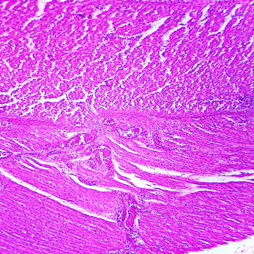 Human Muscle Tissues Microscope Slide Set