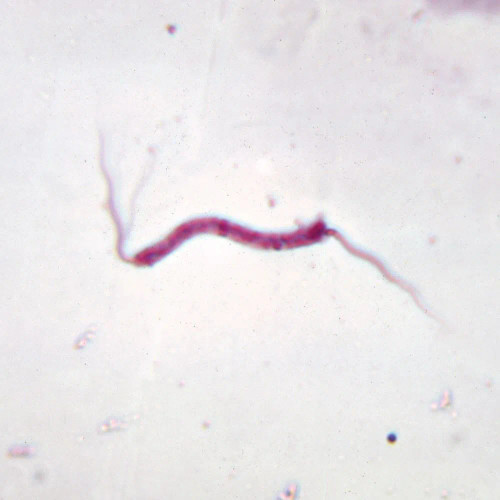Bacterial Flagella Slide, Polar Amphitrichous, w.m.