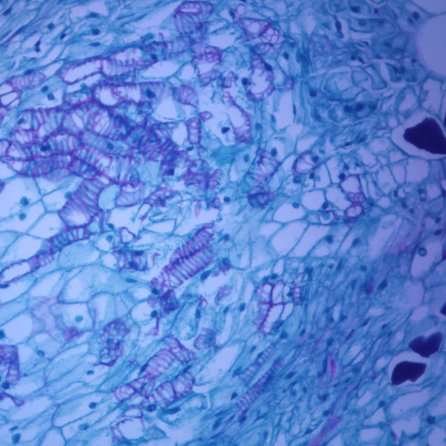 Crown Gall, sec., 12 µm Microscope Slide