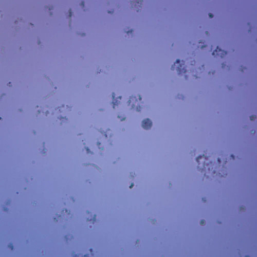 Mixed Amoebic Infection, smear Microscope Slide