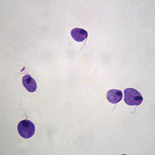 Trichomonas vaginalis Slide, Smear
