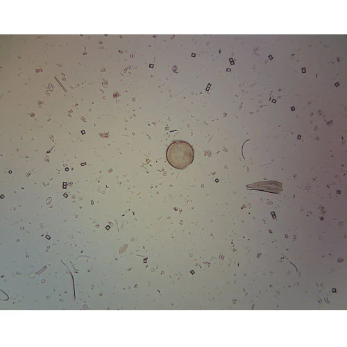 Diatomaceous Earth, w.m. Microscope Slide
