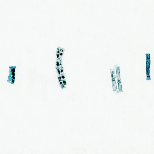 Spirogyra Scalariform Conjugation, All Stages, w.m. Microscope Slide