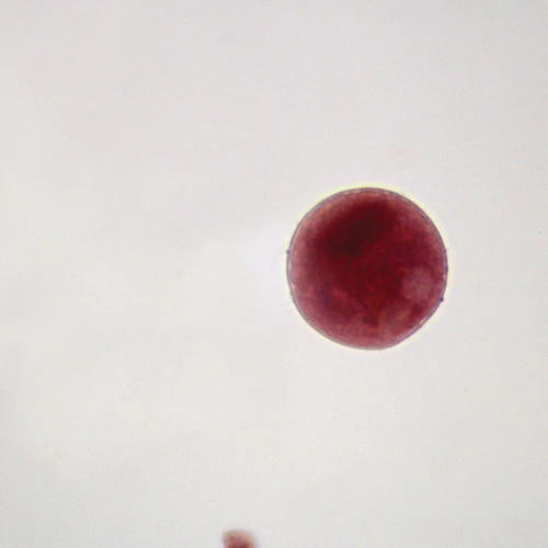 Balantidium coli Cysts, smear Microscope Slide