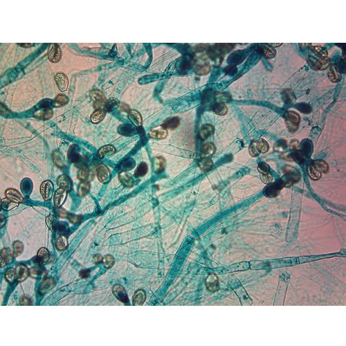 Allomyces Sporophyte, w.m. Microscope Slide