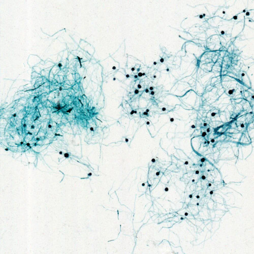 Saprolegnia, w.m. Microscope Slide