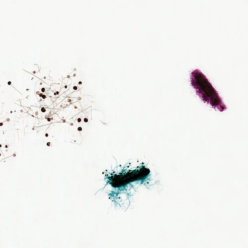Mold Types Slide, w.m.