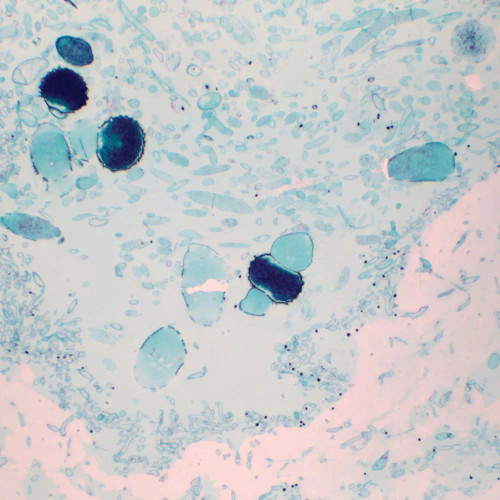 Rhizopus Developing Zygospores, sec. Microscope Slide