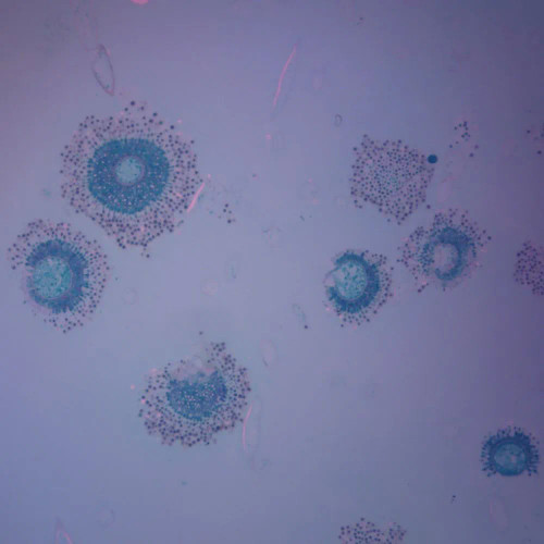 Aspergillus Conidiophores, sec., Thin Microscope Slide