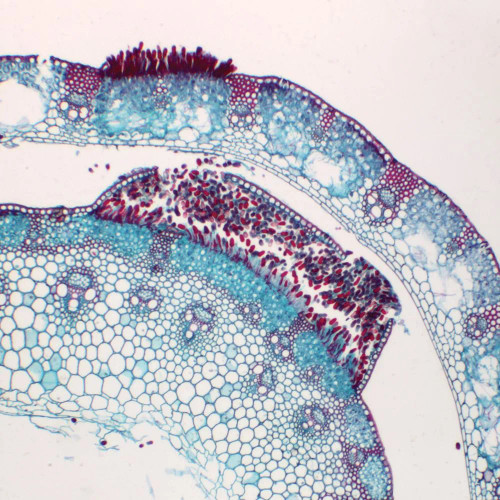 Puccinia graminis Uredia, sec., 12 µm Microscope Slide