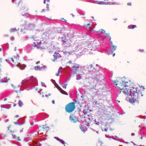 Lichen, mac. Microscope Slide