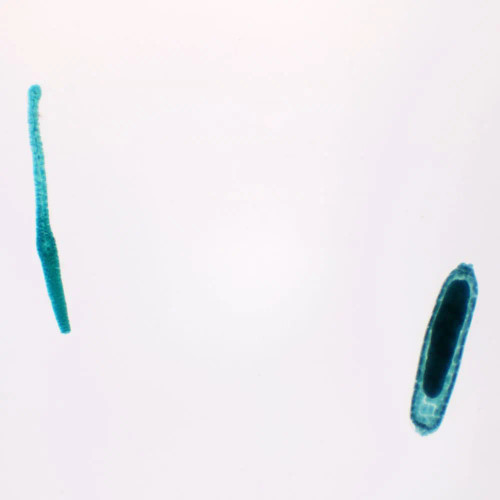 Moss Antheridia and Archegonia, w.m. Microscope Slide