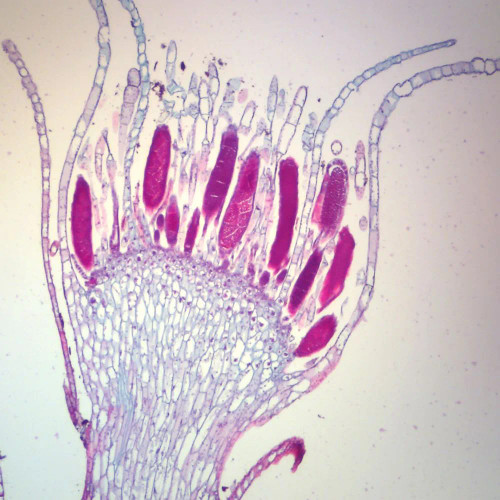 Mnium Antheridial Head, l.s., 12 µm Microscope Slide