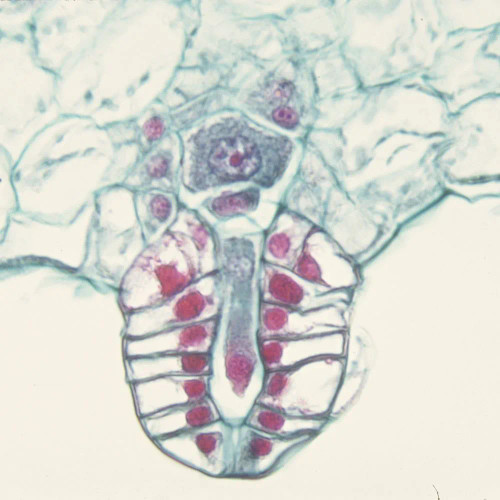 Fern Archegonia, sec., 12 µm Microscope Slide